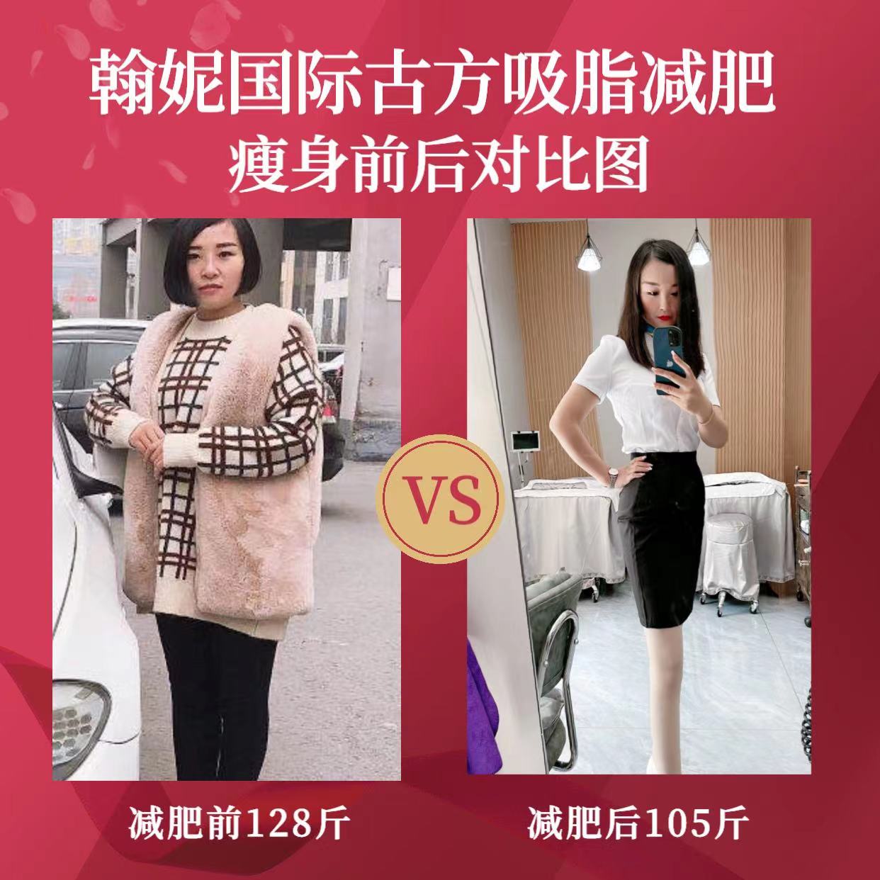 古方减肥